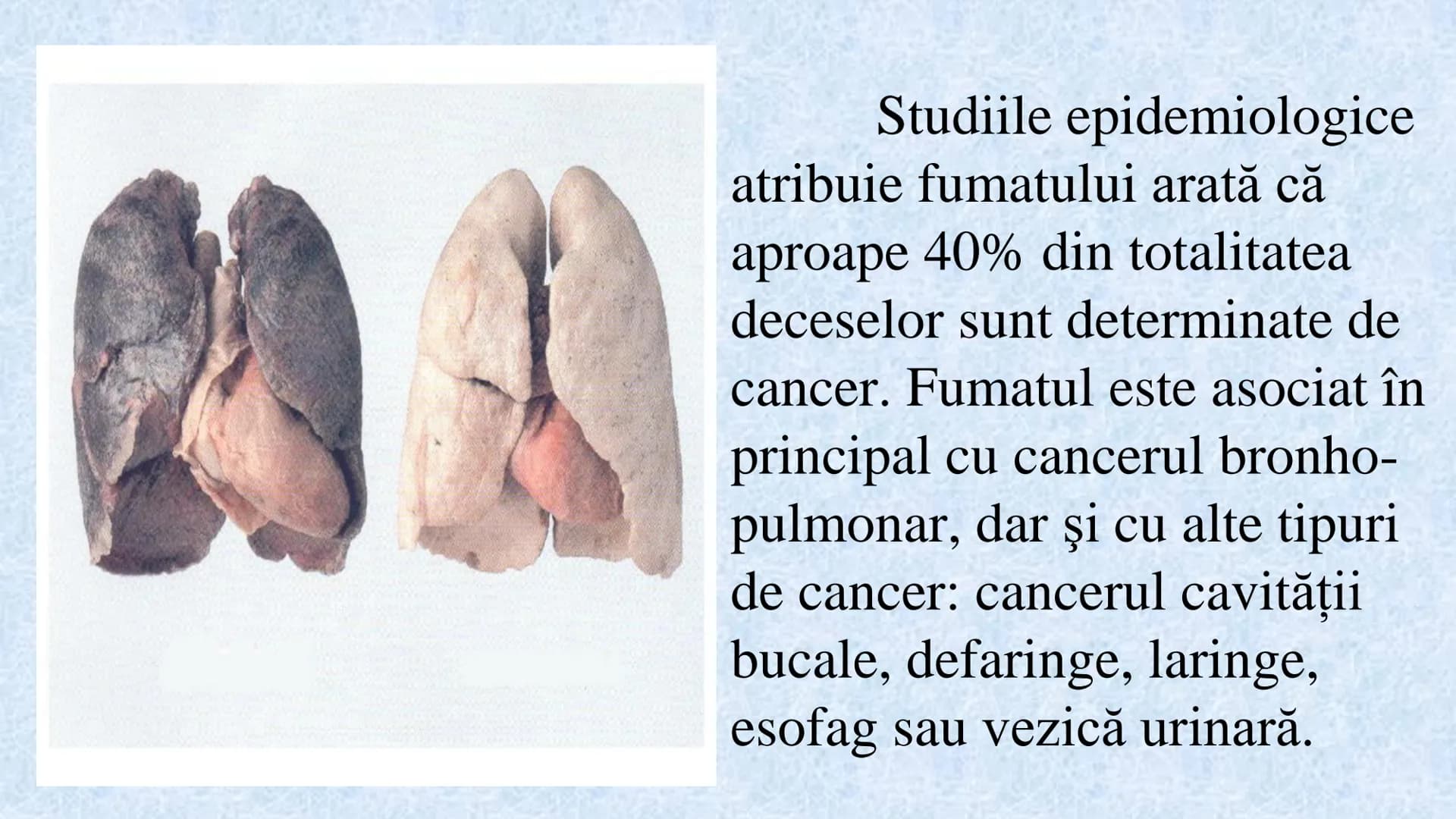 # Acizii nucleici sunt ADN-ul și ARN-ul

## ADN

- Sediul principal al ADN-ului
este nucleul celulelor.
- Sedii secundare sunt:
mitocondriil