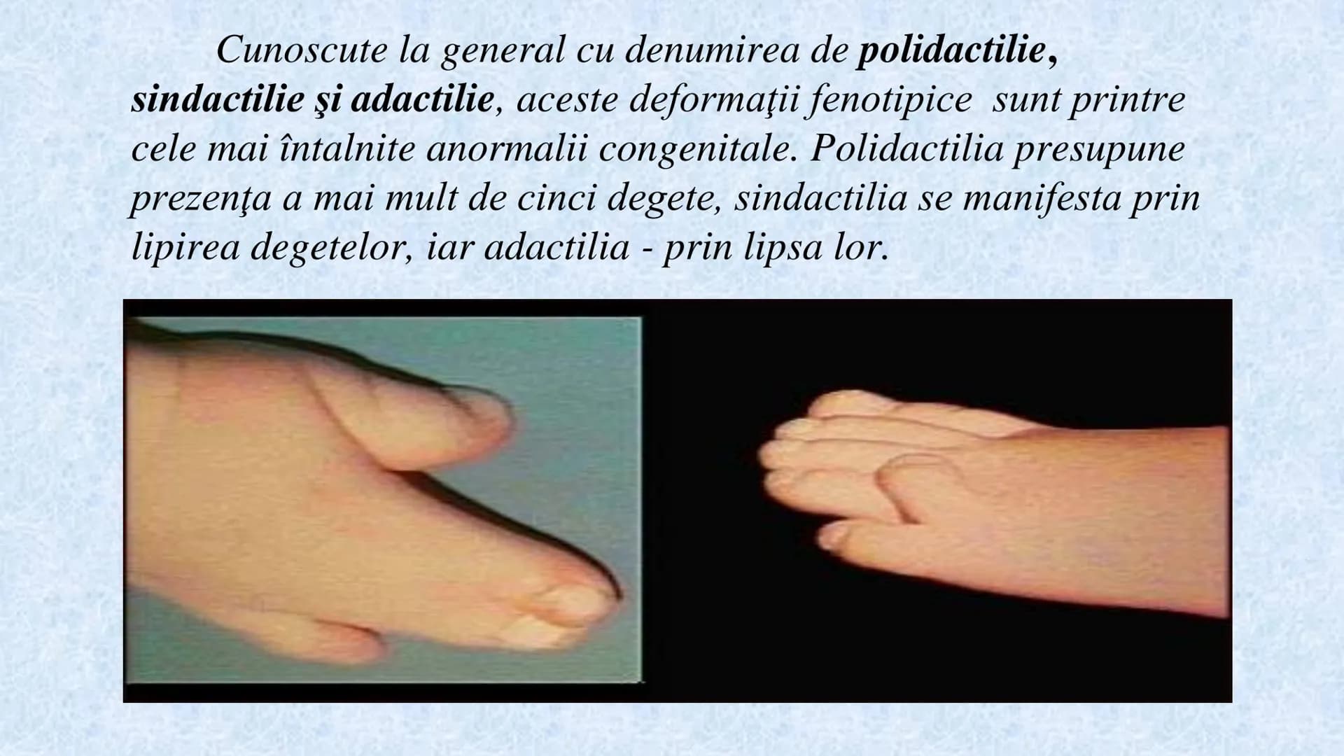 # Acizii nucleici sunt ADN-ul și ARN-ul

## ADN

- Sediul principal al ADN-ului
este nucleul celulelor.
- Sedii secundare sunt:
mitocondriil