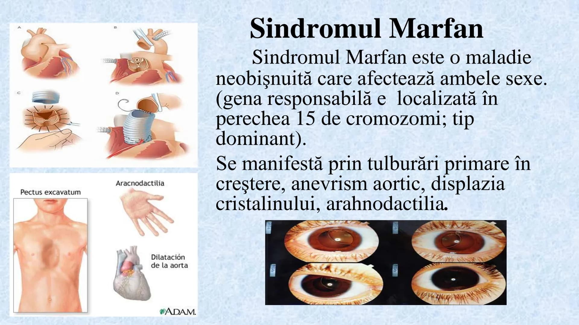 # Acizii nucleici sunt ADN-ul și ARN-ul

## ADN

- Sediul principal al ADN-ului
este nucleul celulelor.
- Sedii secundare sunt:
mitocondriil