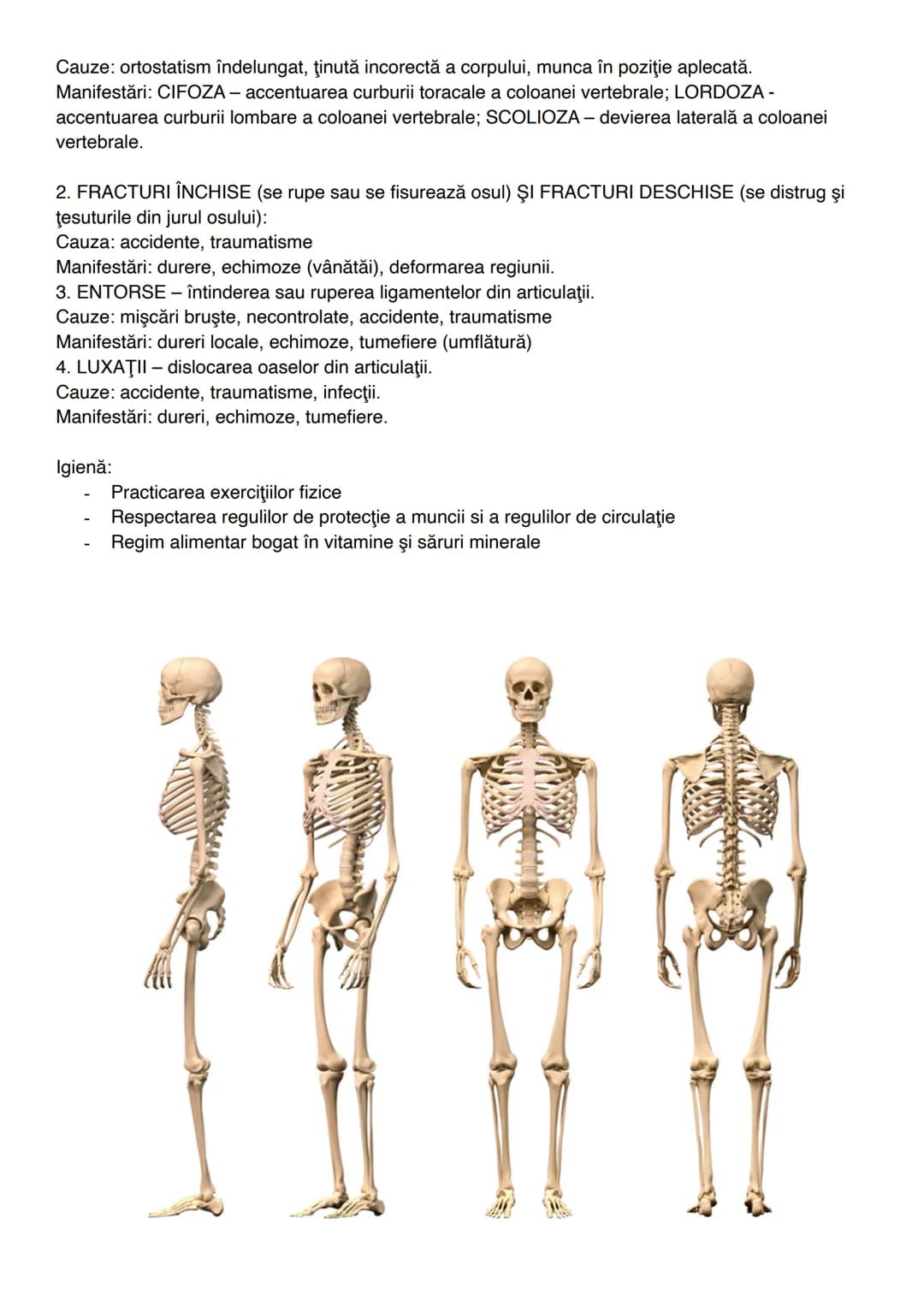 --- OCR Start ---
Parietal
Frontal-
Craniul-
Zigomatic
Cutia Stern-
tora-
cica Coaste
Temporal
Maxila
Mandibula
Clavicula
Omoplat
Cartilaje 