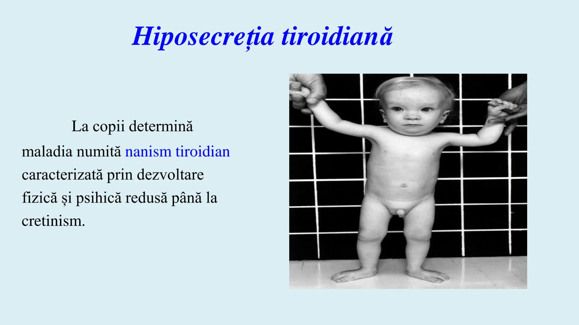 # BACALAUREAT
# ANATOMIE ŞI FIZIOLOGIE UMANĂ
# SISTEMUL ENDOCRIN •
Sistemul endocrin reprezintă
totalitatea glandelor endocrine
din corp.