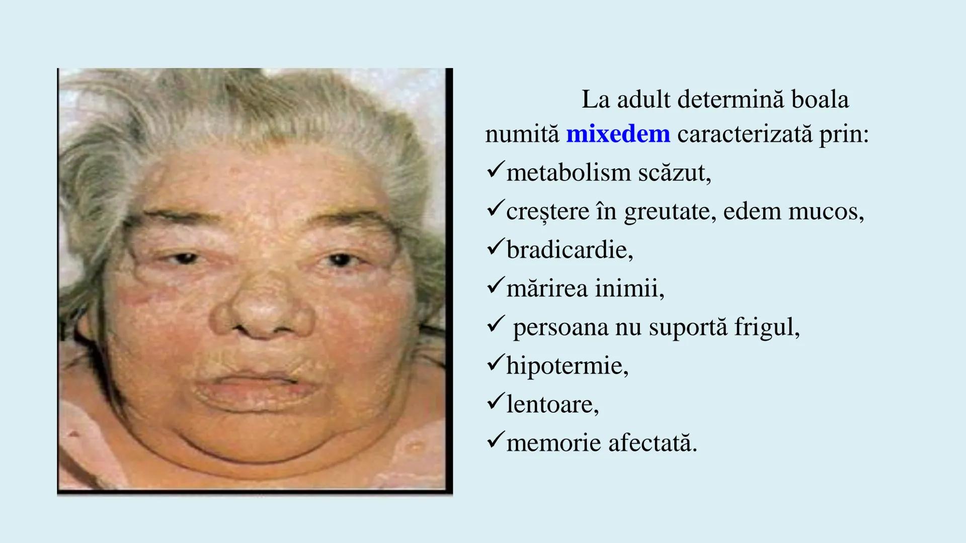 # BACALAUREAT
# ANATOMIE ŞI FIZIOLOGIE UMANĂ
# SISTEMUL ENDOCRIN •
Sistemul endocrin reprezintă
totalitatea glandelor endocrine
din corp.