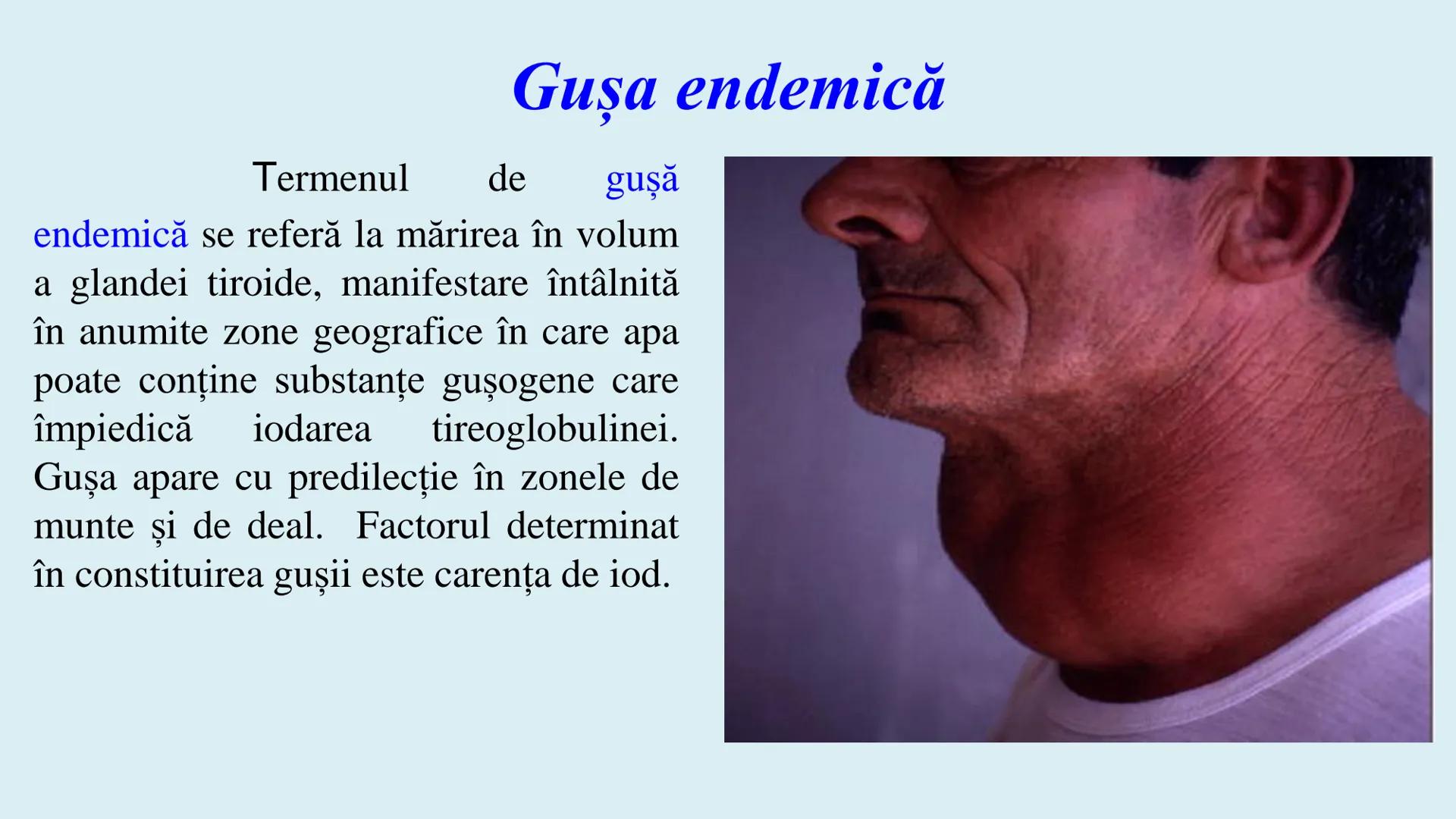 # BACALAUREAT
# ANATOMIE ŞI FIZIOLOGIE UMANĂ
# SISTEMUL ENDOCRIN •
Sistemul endocrin reprezintă
totalitatea glandelor endocrine
din corp.
