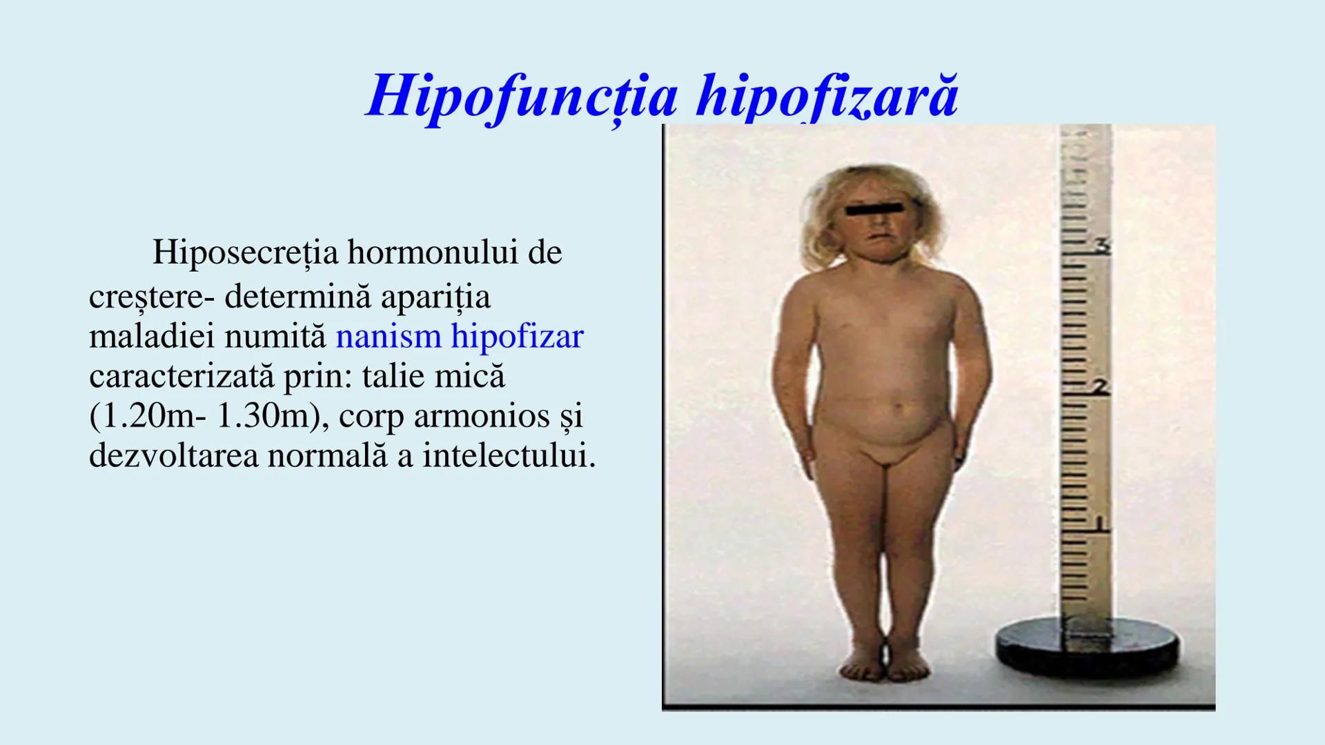 # BACALAUREAT
# ANATOMIE ŞI FIZIOLOGIE UMANĂ
# SISTEMUL ENDOCRIN •
Sistemul endocrin reprezintă
totalitatea glandelor endocrine
din corp.