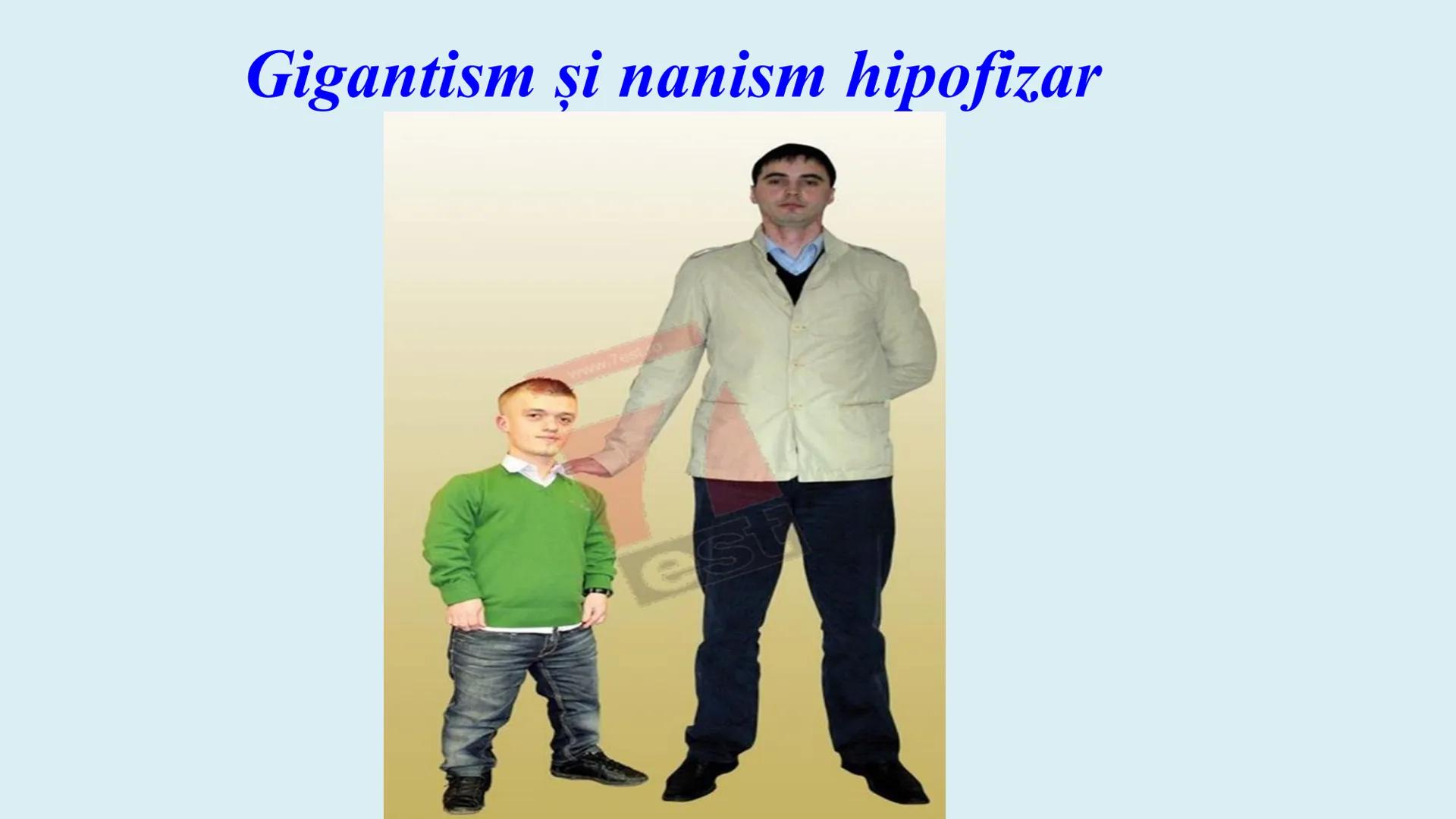 # BACALAUREAT
# ANATOMIE ŞI FIZIOLOGIE UMANĂ
# SISTEMUL ENDOCRIN •
Sistemul endocrin reprezintă
totalitatea glandelor endocrine
din corp.