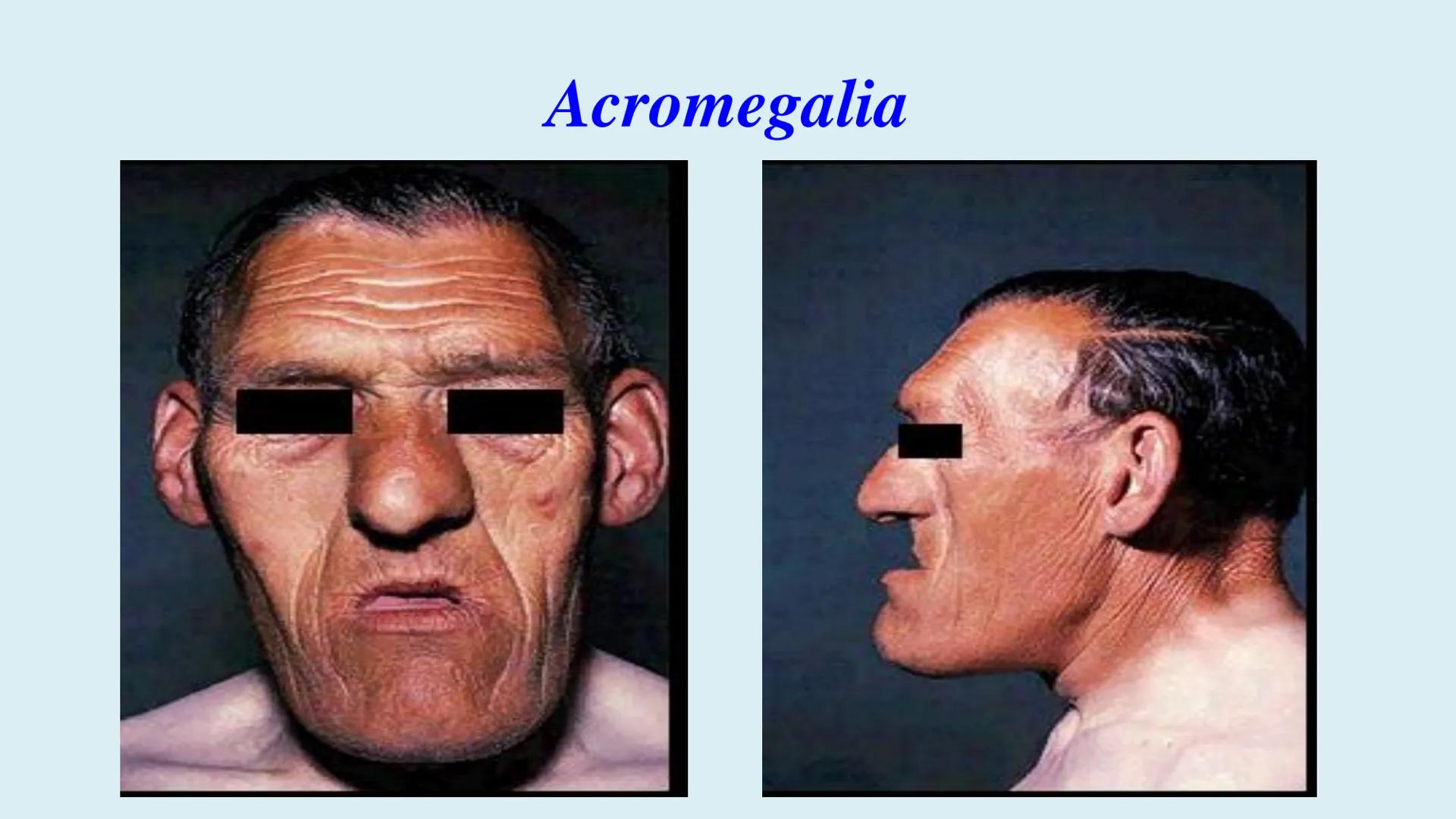 # BACALAUREAT
# ANATOMIE ŞI FIZIOLOGIE UMANĂ
# SISTEMUL ENDOCRIN •
Sistemul endocrin reprezintă
totalitatea glandelor endocrine
din corp.