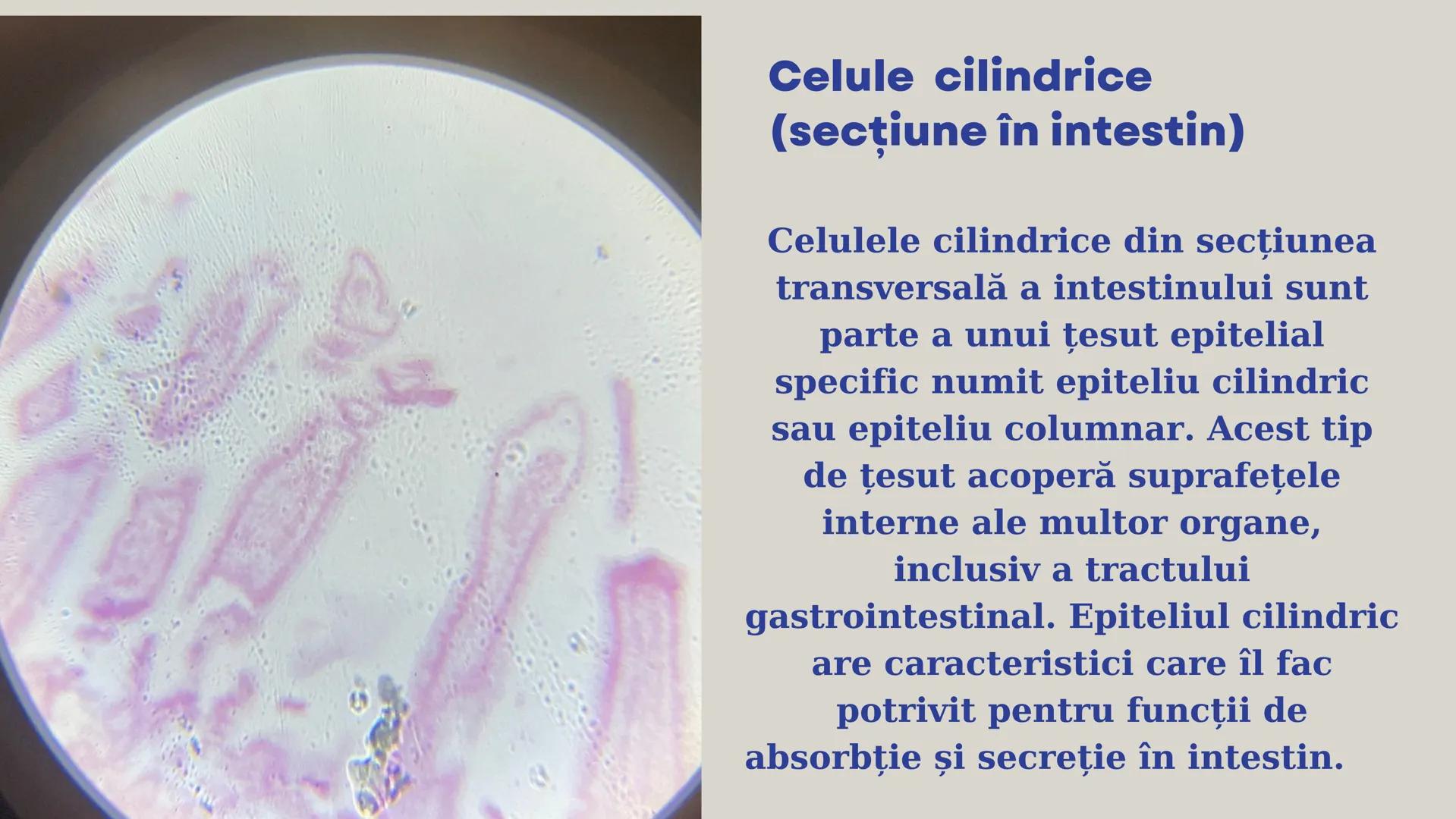 Lp - Țesuturi
vegetale si
animale # ȚESUTURI VEGETALE # Cromoplaste la
Rosa canina
Cromoplastele sunt organite celulare
specializate în pla