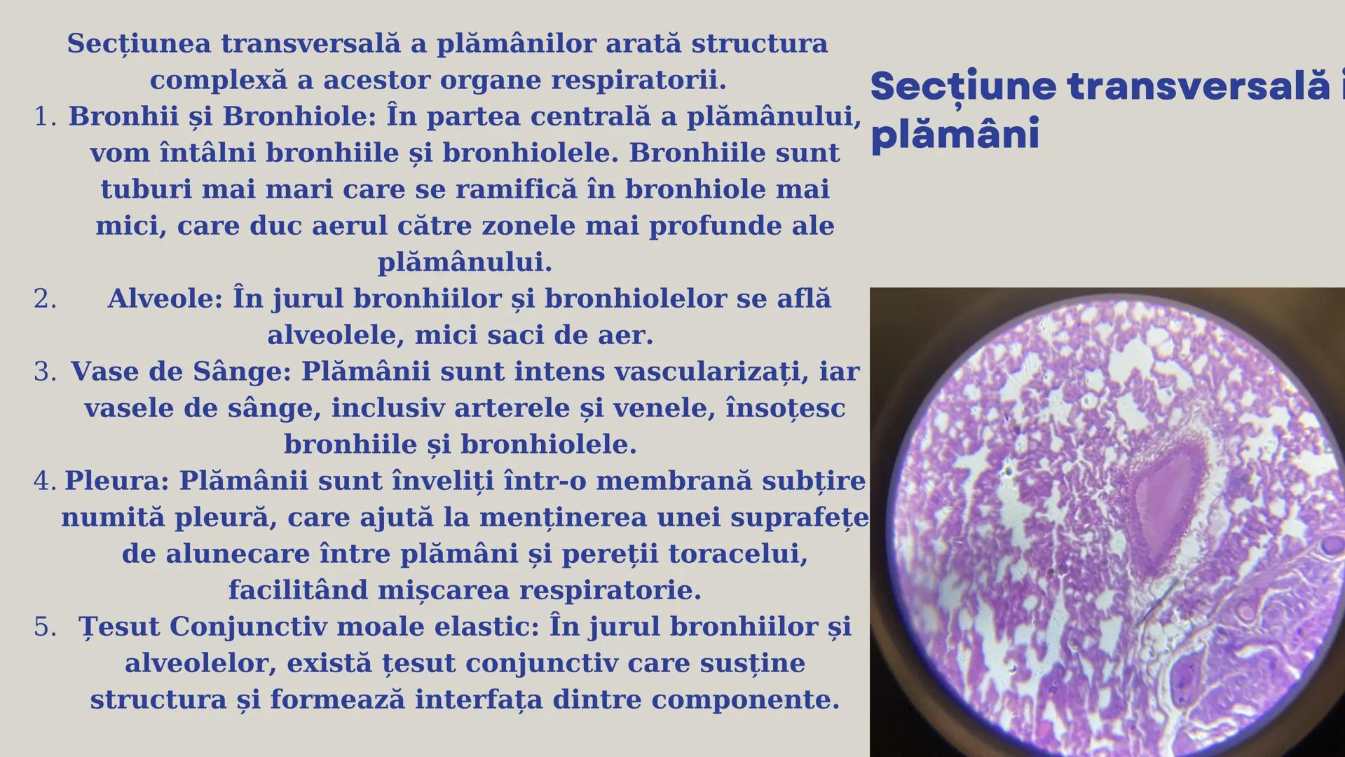 Lp - Țesuturi
vegetale si
animale # ȚESUTURI VEGETALE # Cromoplaste la
Rosa canina
Cromoplastele sunt organite celulare
specializate în pla