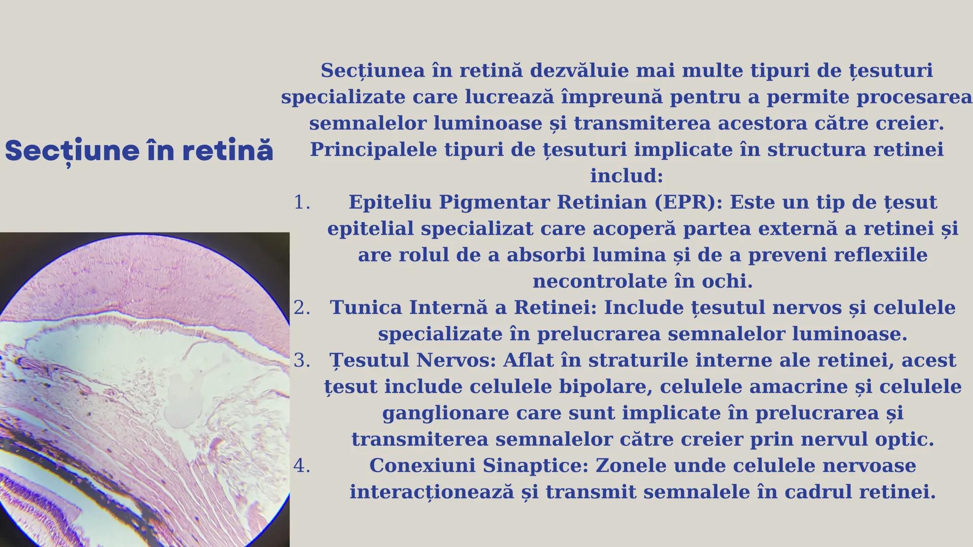 Lp - Țesuturi
vegetale si
animale # ȚESUTURI VEGETALE # Cromoplaste la
Rosa canina
Cromoplastele sunt organite celulare
specializate în pla