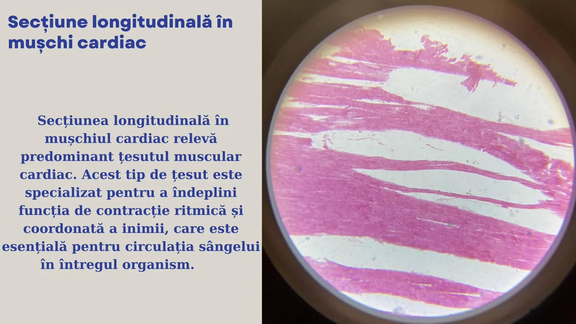 Lp - Țesuturi
vegetale si
animale # ȚESUTURI VEGETALE # Cromoplaste la
Rosa canina
Cromoplastele sunt organite celulare
specializate în pla