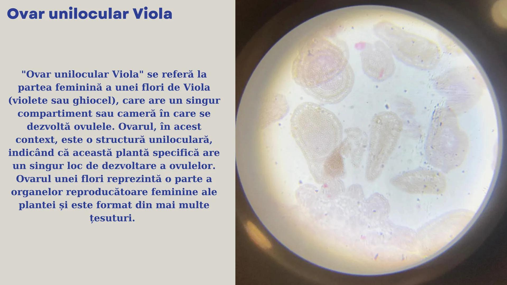 Lp - Țesuturi
vegetale si
animale # ȚESUTURI VEGETALE # Cromoplaste la
Rosa canina
Cromoplastele sunt organite celulare
specializate în pla