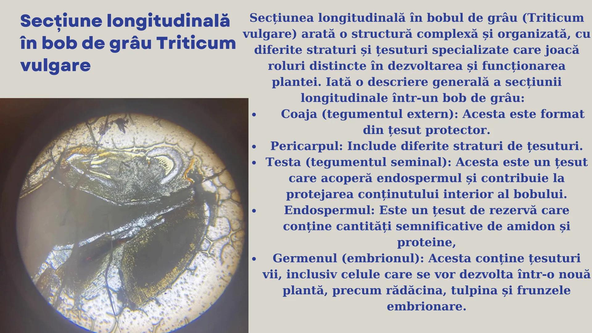 Lp - Țesuturi
vegetale si
animale # ȚESUTURI VEGETALE # Cromoplaste la
Rosa canina
Cromoplastele sunt organite celulare
specializate în pla