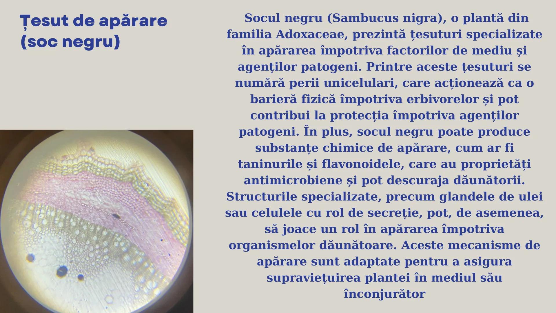 Lp - Țesuturi
vegetale si
animale # ȚESUTURI VEGETALE # Cromoplaste la
Rosa canina
Cromoplastele sunt organite celulare
specializate în pla